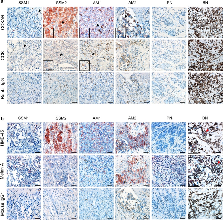 CCKAR Antibody in Immunohistochemistry (IHC)