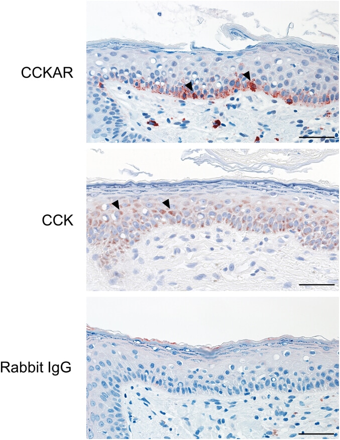 CCKAR Antibody in Immunohistochemistry (IHC)