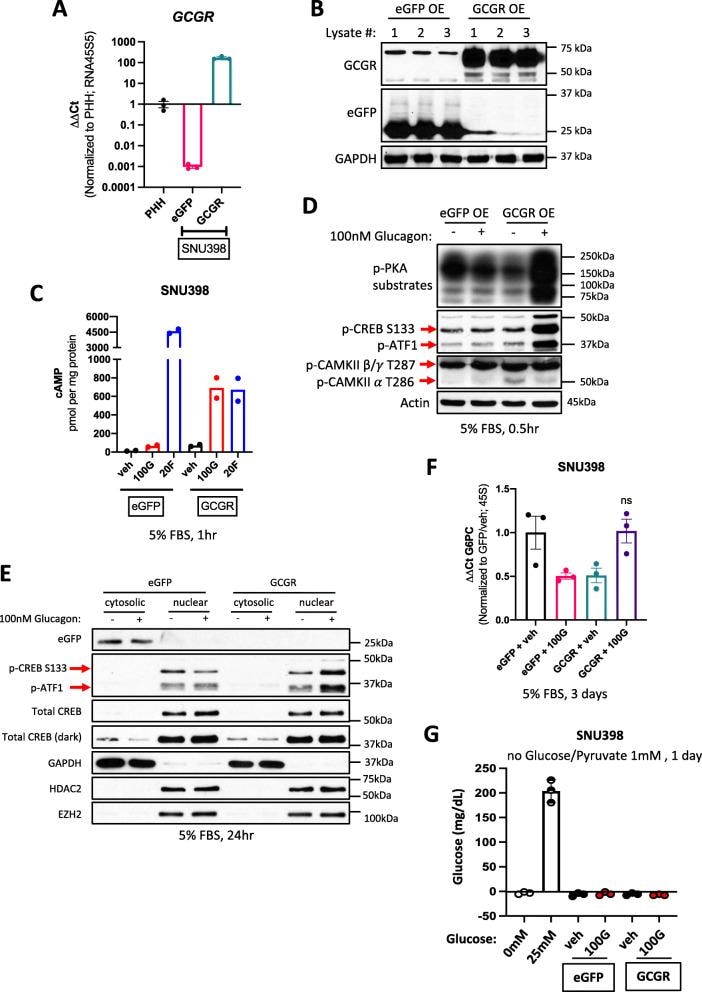 Glucagon Receptor Antibody in Western Blot (WB)