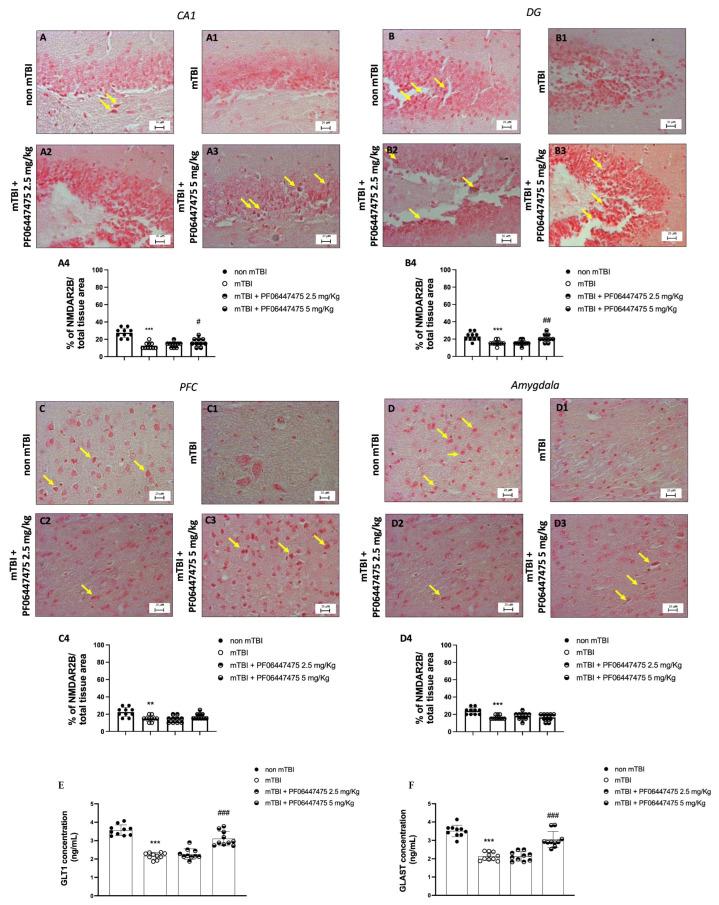 NMDAR2B Antibody in Immunohistochemistry (IHC)