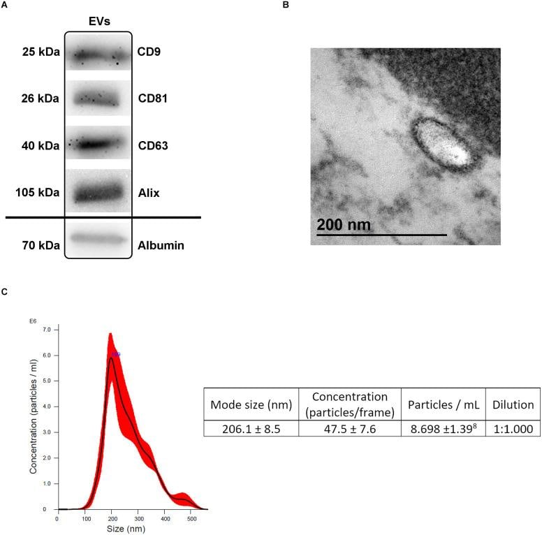 Alix Antibody in Western Blot (WB)