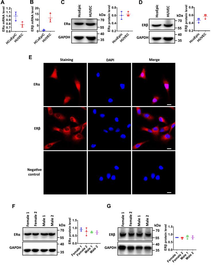 Estrogen Receptor beta Antibody in Western Blot (WB)