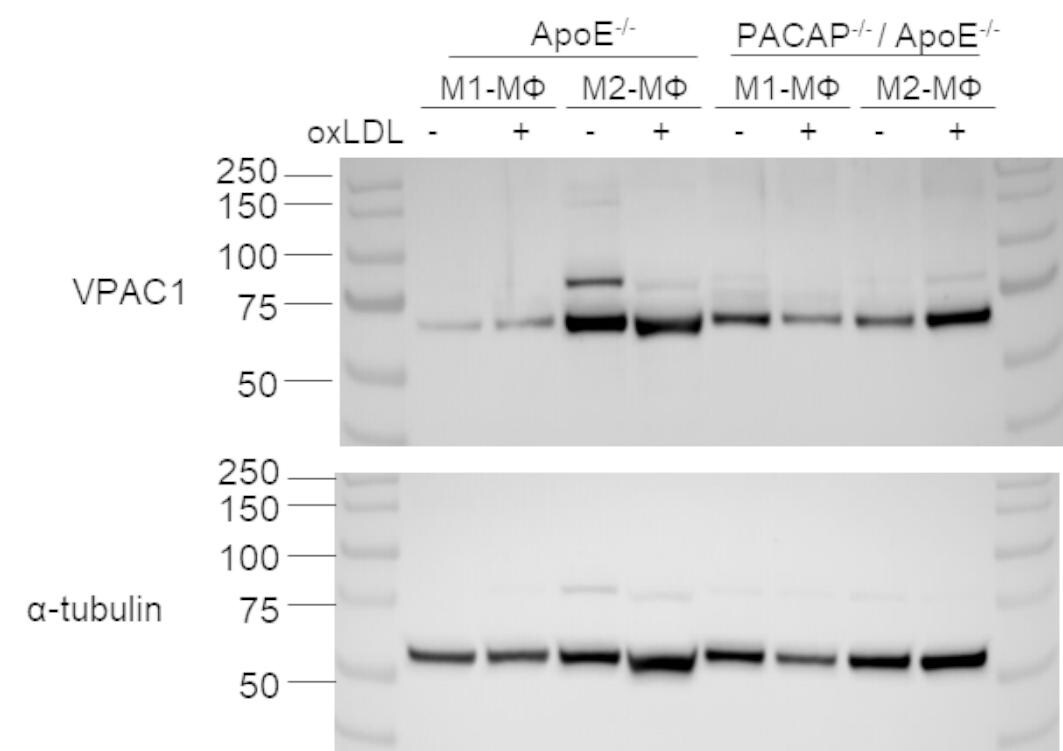 VIPR1 Antibody in Western Blot (WB)