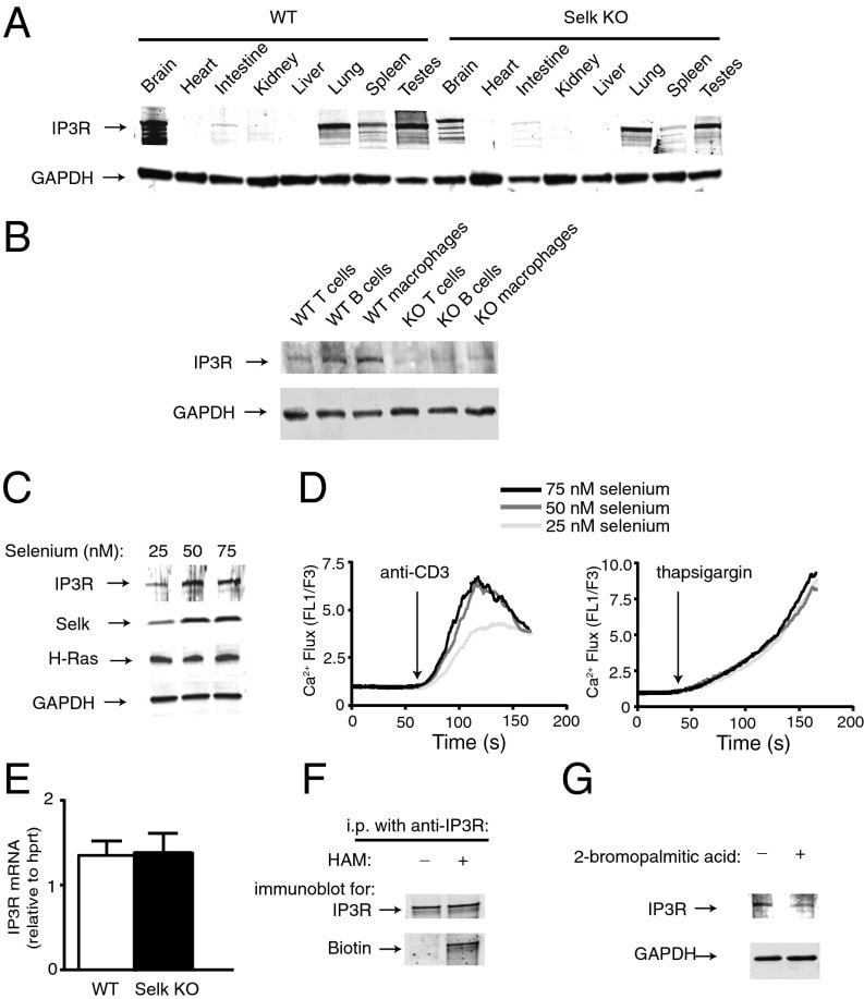 IP3 Receptor 1 Antibody in Immunoprecipitation (IP)