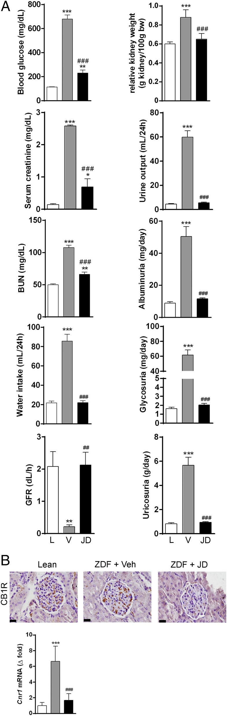 Cannabinoid Receptor 1 Antibody