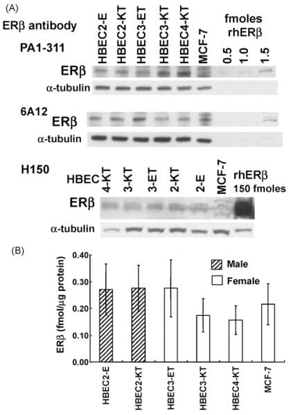 Estrogen Receptor beta Antibody in Western Blot (WB)