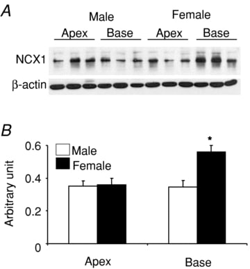 Sodium/Calcium Exchanger Antibody in Western Blot (WB)