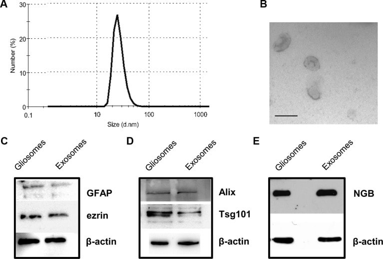 Alix Antibody in Western Blot (WB)