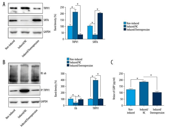 TRPV1 Antibody in Western Blot (WB)