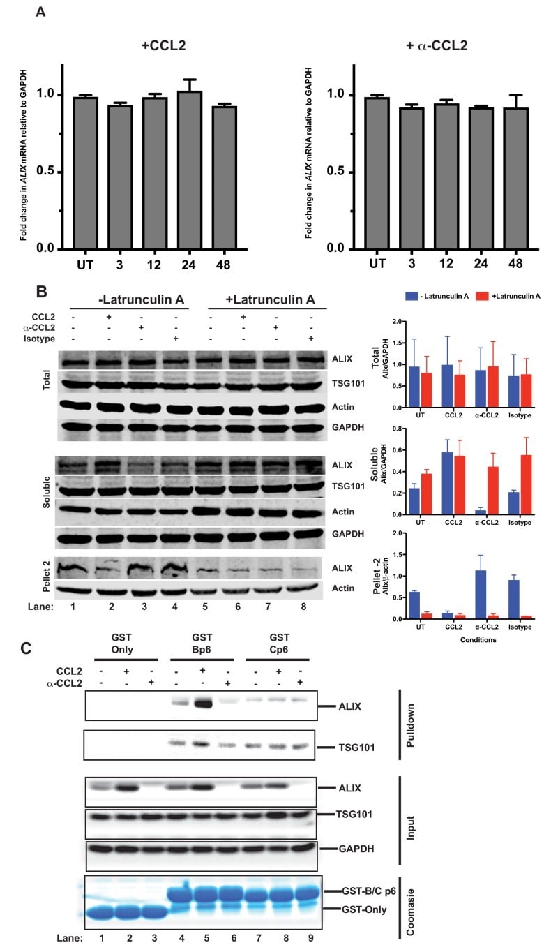 Alix Antibody in Western Blot (WB)