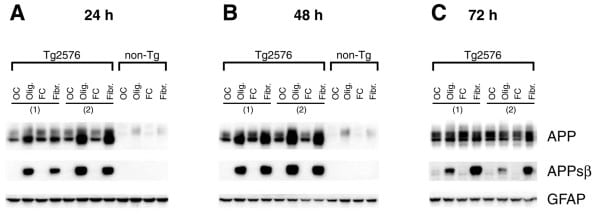 BACE1 Antibody in Western Blot (WB)