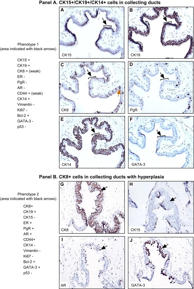 Cytokeratin 15 Antibody in Immunohistochemistry (IHC)