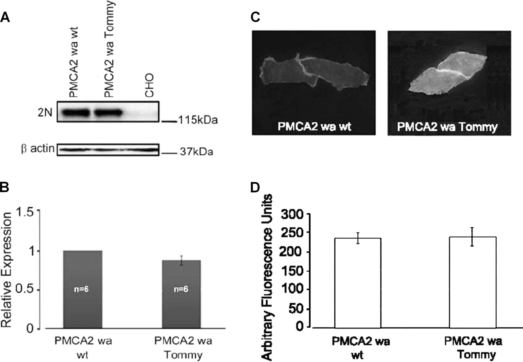 PMCA2 ATPase Antibody in Immunocytochemistry (ICC/IF)