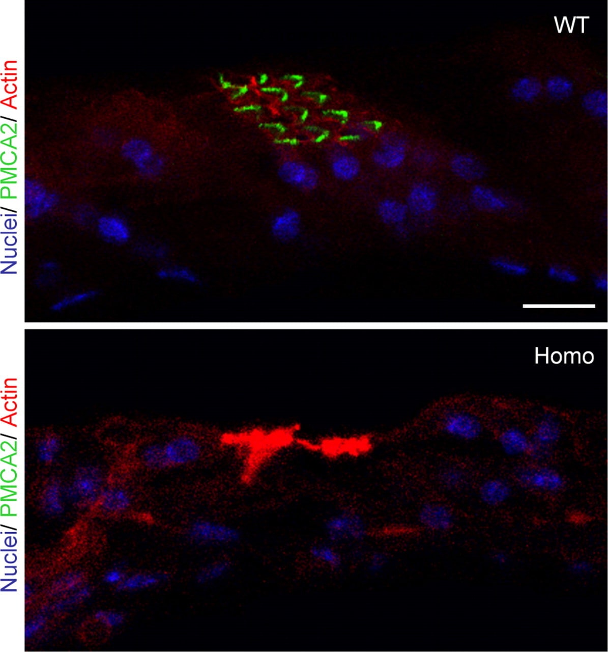 PMCA2 ATPase Antibody in Immunohistochemistry (IHC)