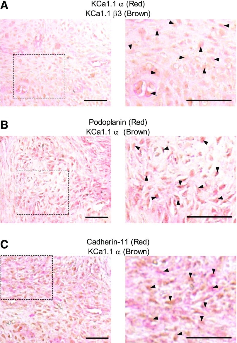 CDH11 Antibody in Immunohistochemistry (IHC)