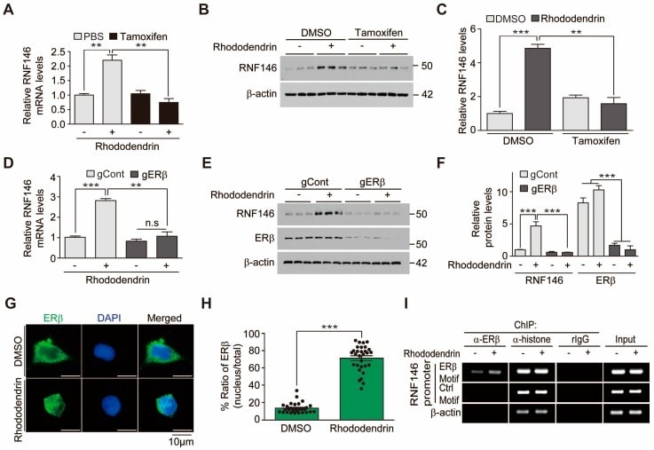 Estrogen Receptor beta Antibody in ChIP Assay (ChIP)