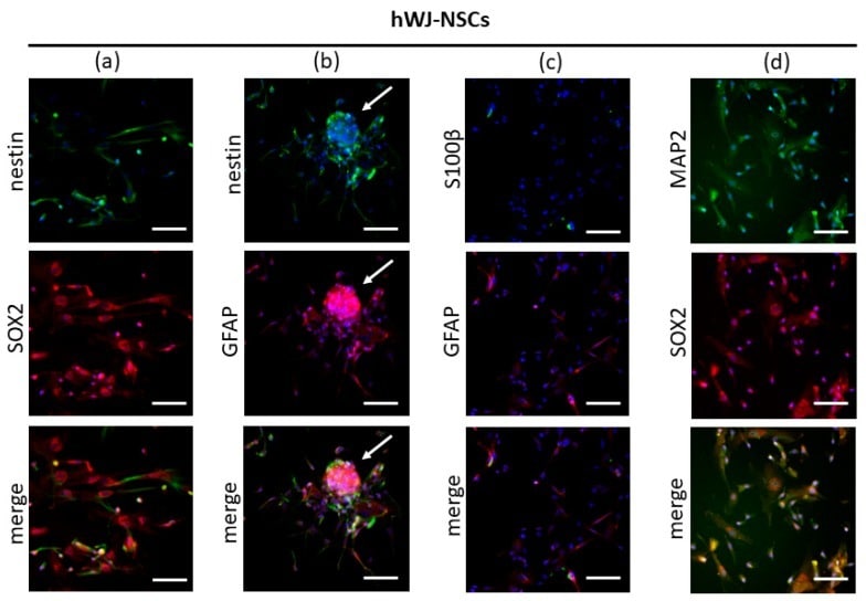 S100B Antibody in Immunocytochemistry (ICC/IF)