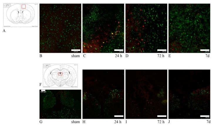 Beta Amyloid Antibody 51 2700