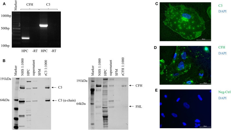 Complement C3 Antibody in Western Blot (WB)