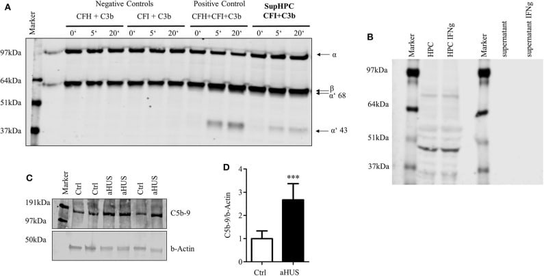 Complement C3 Antibody in Western Blot (WB)