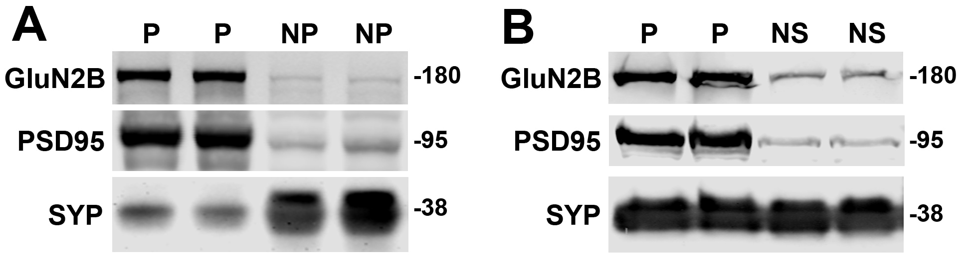 NMDAR2B Antibody in Western Blot (WB)